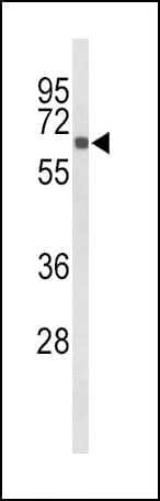 CYP27B1 Antibody (aa482-508)