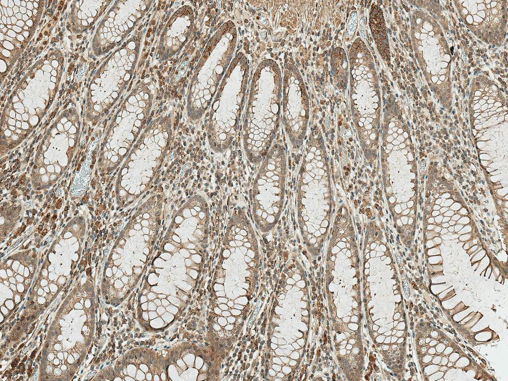 BCL2 / Bcl-2 Antibody (PerCP)
