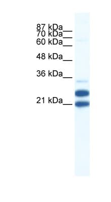 TRIM34 / RNF21 Antibody (aa49-98)