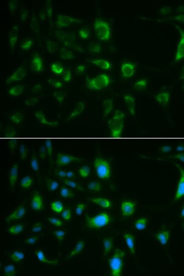 Polyclonal Rabbit anti-Human TLR8 Antibody (IHC, IF, WB)
