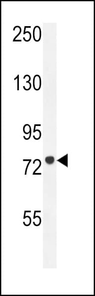 IHC-plus™ Polyclonal Rabbit anti-Human CPT1C Antibody (aa752-782, IHC, WB)