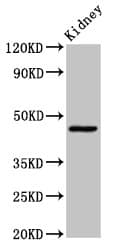 Polyclonal Rabbit anti-Human COX15 Antibody (IHC, WB)