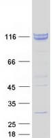 Human ZCCHC8 Protein (Recombinant Myc-DDK (Flag))
