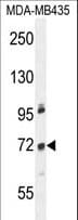 Polyclonal Rabbit anti-Human ZNF510 Antibody (aa101-130, WB)