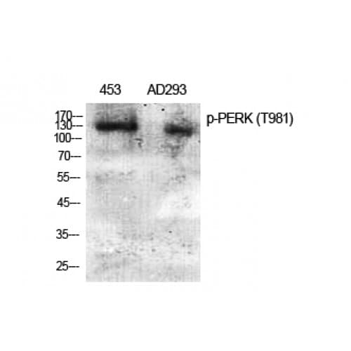 EIF2AK3 / PERK Antibody (920-1000 aa)