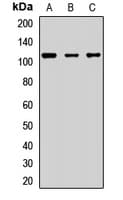 RNASEL / RNase L Antibody