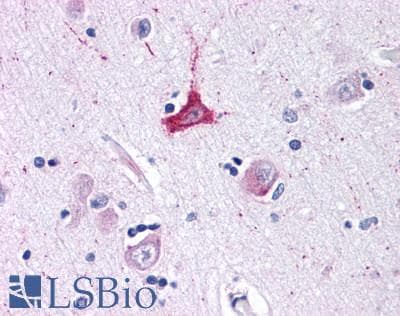 PathPlus™ ADORA1 / Adenosine A1 Receptor Antibody (Cytoplasmic Domain)