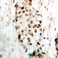 Polyclonal Rabbit anti-Human SOX9 Antibody (Internal, IHC, IF, WB)