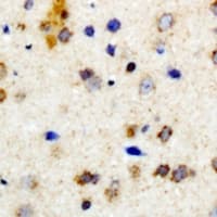ART5 Antibody