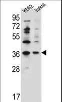 Polyclonal Rabbit anti-Human PPP1R3G Antibody (aa269-298, WB)
