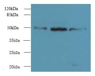 UBXN6 / UBXD1 Antibody