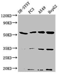 Polyclonal Rabbit anti-Human NAGPA Antibody (IHC, WB)