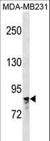 NR3C1/Glucocorticoid Receptor Antibody (aa560-588)