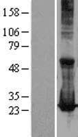RAB17 Protein (Over-Expression Lysate Myc-DDK (Flag))