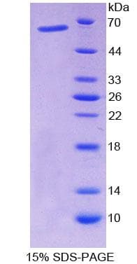 Rat NF1A / NFIX Protein (Recombinant His-GST)