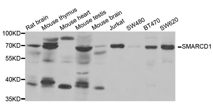 Polyclonal Rabbit anti-Human SMARCD1 / BAF60A Antibody (IHC, WB)