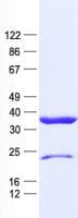 Human PRKAB2 / AMPK Beta 2 Protein (Recombinant His, N-Terminal)