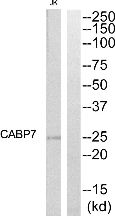 Polyclonal Rabbit anti-Human CABP7 Antibody (IHC, WB)