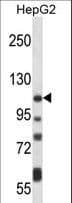 Polyclonal Rabbit anti-Human ATP2B4 / PMCA4 Antibody (aa1174-1202, WB)