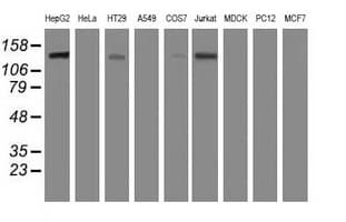 Monoclonal Mouse anti-Human HDAC6 Antibody (clone OTI1B3, IHC, IF, WB)