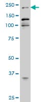 IHC-plus™ EP300 / p300 Antibody (clone 1D2)
