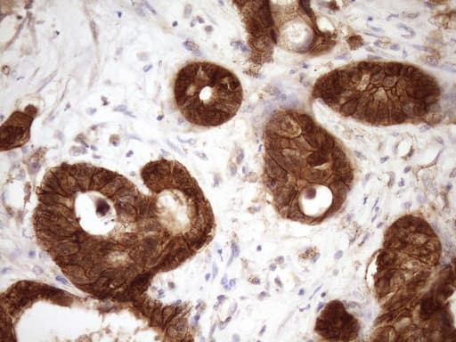 CTNNB1 / Beta Catenin Antibody (aa29-118, clone OTI2F10, Carrier-free)