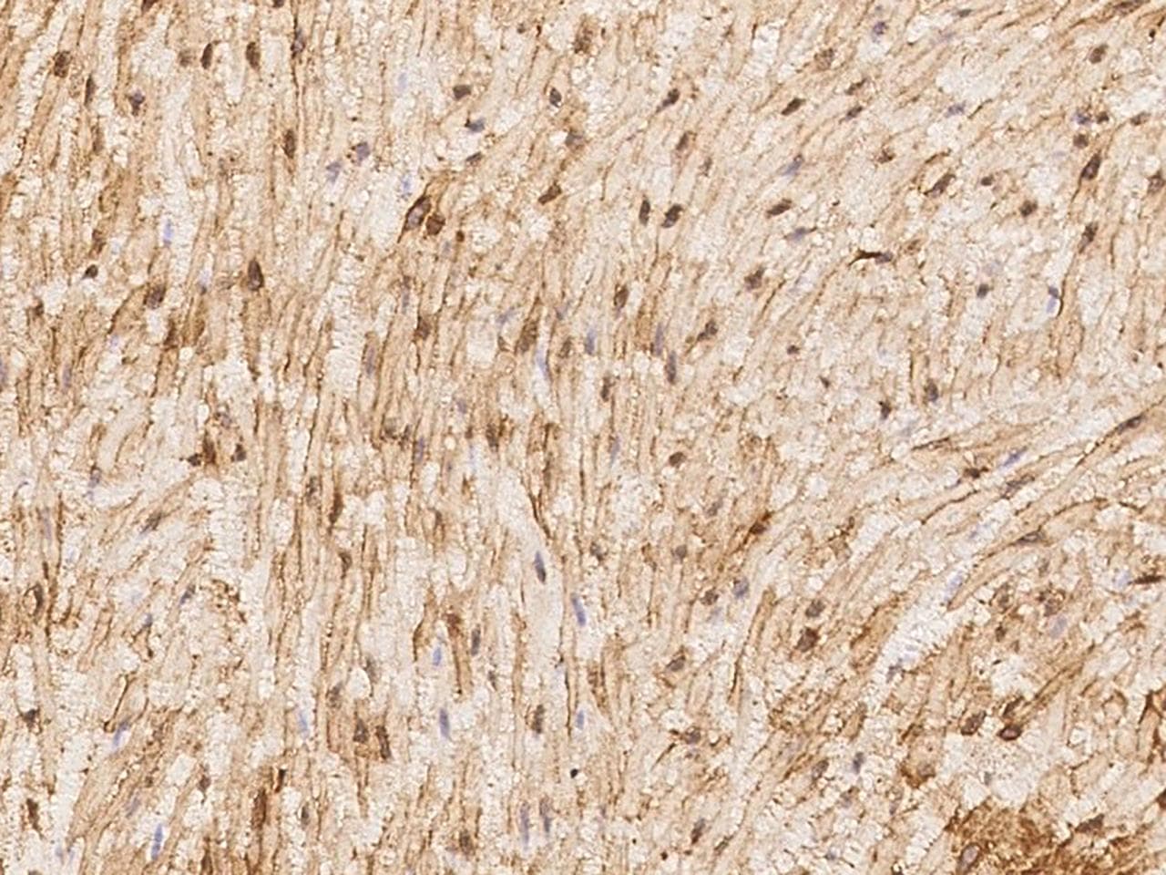 Polyclonal Rabbit anti-Human HAS1 / HAS Antibody (IHC)