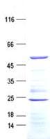 Human ARHGAP8 Protein (Recombinant His, N-Terminal)