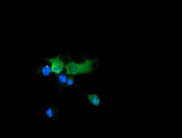 CTAG1B / NY-ESO-1 Antibody (clone OTI4G1)