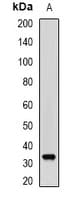 Prostaglandin D Synthase Antibody