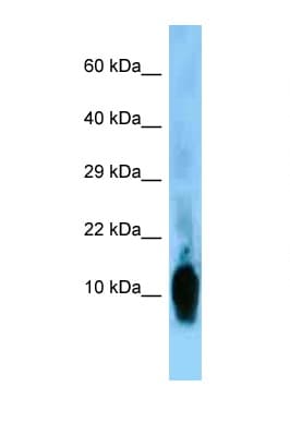 NRGN / Neurogranin Antibody (aa6-55, FITC)