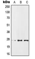 PPP1R1A / IPP1 Antibody (Internal)