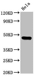 CSNK1E / CK1 Epsilon Antibody (aa1-416)