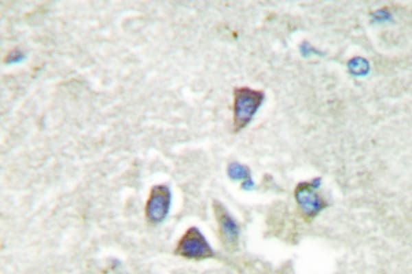 ACVR1B / ALK4 Antibody (Gly111)