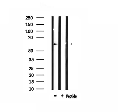 ARSI / Arylsulfatase I Antibody