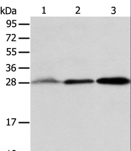ABH2 / ALKBH2 Antibody