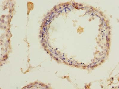 ZCCHC4 Antibody