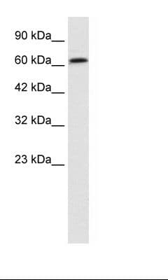 PSIP1 / LEDGF Antibody (aa311-360)