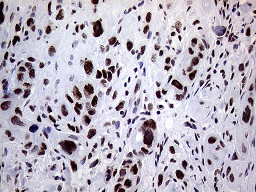 RING1 Antibody (aa88-362, clone OTI3G7, Carrier-free)