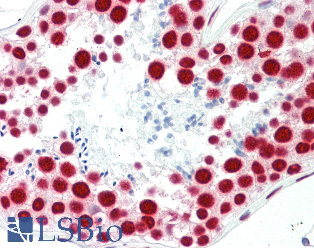 IHC-plus™ TAF15 Antibody (clone 4D71)