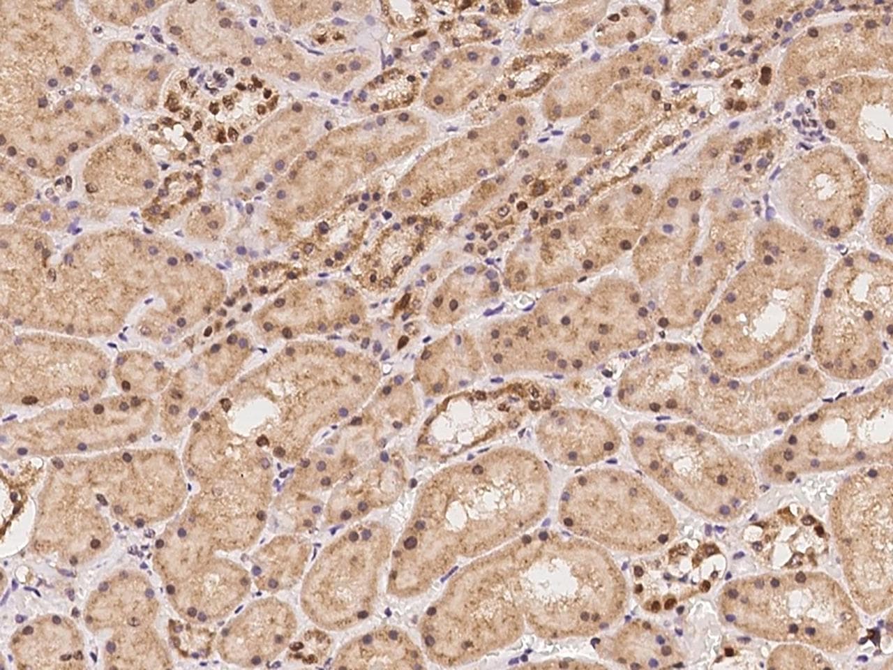Polyclonal Rabbit anti-Human NOLC1 Antibody (IHC, IF)