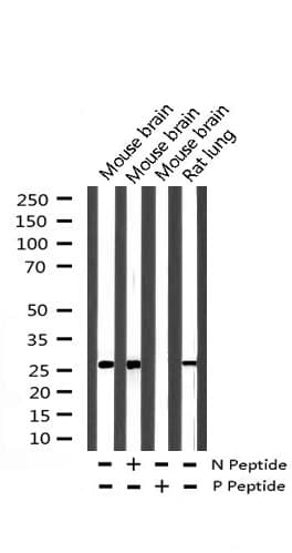 Polyclonal Rabbit anti-Human CDKN1A / WAF1 / p21 Antibody (phospho-Thr145, IHC, IF, WB)