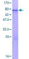 Human ZNF200 Protein (Recombinant GST)