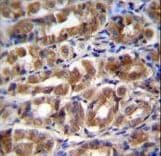 I-FABP / FABP2 Antibody (aa1-30)