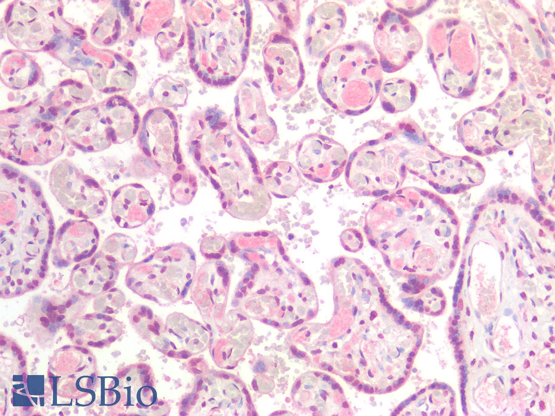PathPlus™ SIAH2 Antibody