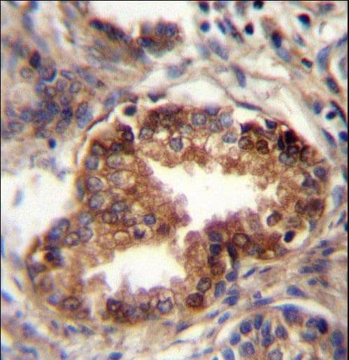 RAB3D Antibody (aa185-212)