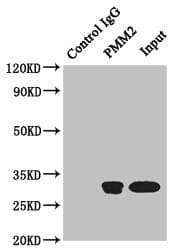 Polyclonal Rabbit anti-Human PMM2 Antibody (IHC, WB)
