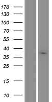 MARCH9 Protein (Over-Expression Lysate Myc-DDK (Flag))