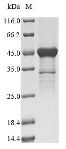 Human RPS3 / Ribosomal Protein S3 (Recombinant 6His-SUMO, N-terminus)