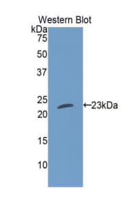 CTF1 / Cardiotrophin-1 Antibody (aa1-201)